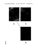 Monoclonal Antibodies Against Claudin-18 for Treatment of Cancer diagram and image