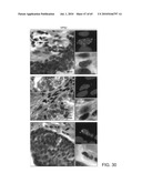 Gammaretrovirus associated with cancer diagram and image