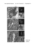 Gammaretrovirus associated with cancer diagram and image