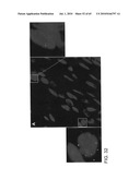 Gammaretrovirus associated with cancer diagram and image