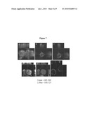 METHODS OF TREATING OR PREVENTING BIOFILM ASSOCIATED INFECTIONS WITH FREE AVAILABLE CHLORINE FREE AVAILABLE CHLORINE WATER diagram and image