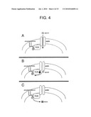 Methods And Compositions For Modulating Keratinocyte Function diagram and image