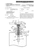 DENTAL IMPLANT diagram and image