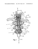 DENTAL IMPLANT diagram and image