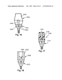 DENTAL IMPLANT diagram and image