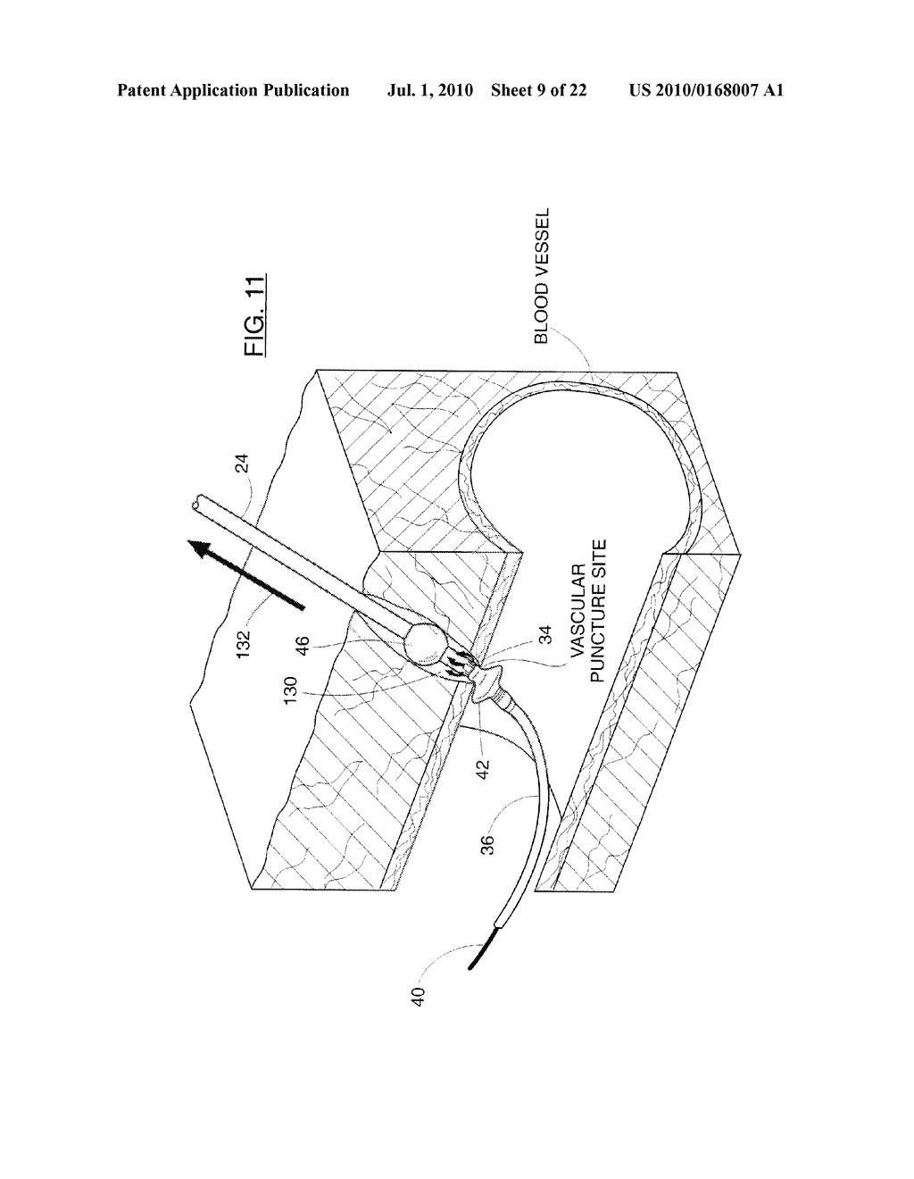 Systems and Methods for Applying Cross-Linked Mechanical Barriers - diagram, schematic, and image 10