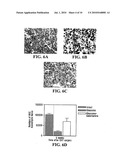 GALANTAMINE AS A NEUROPROTECTIVE DRUG FOR RETINAL GANGLION CELLS diagram and image