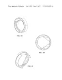 VIEW OPTIMIZER AND STABILIZER FOR USE WITH SURGICAL SCOPES diagram and image