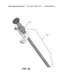 VIEW OPTIMIZER AND STABILIZER FOR USE WITH SURGICAL SCOPES diagram and image