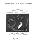 VIEW OPTIMIZER AND STABILIZER FOR USE WITH SURGICAL SCOPES diagram and image