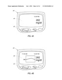 SYSTEM AND METHODS FOR PROCESSING ANALYTE SENSOR DATA diagram and image