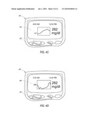 SYSTEM AND METHODS FOR PROCESSING ANALYTE SENSOR DATA diagram and image