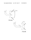 MULTIPLE SHELL CONSTRUCTION TO EMULATE CHAMBER CONTRACTION WITH A MAPPING SYSTEM diagram and image