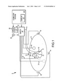 Devices and Methods for Catheter Localization diagram and image