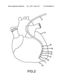 Devices and Methods for Catheter Localization diagram and image