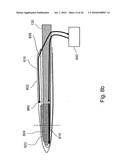 Apparatus for Protecting a Cavity Wall During Ablation of Tissue Near the Cavity diagram and image