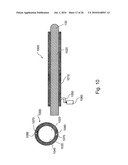 Apparatus for Protecting a Cavity Wall During Ablation of Tissue Near the Cavity diagram and image