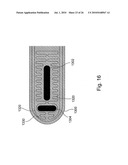 Apparatus for Protecting a Cavity Wall During Ablation of Tissue Near the Cavity diagram and image