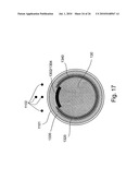 Apparatus for Protecting a Cavity Wall During Ablation of Tissue Near the Cavity diagram and image