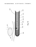 Apparatus for Protecting a Cavity Wall During Ablation of Tissue Near the Cavity diagram and image