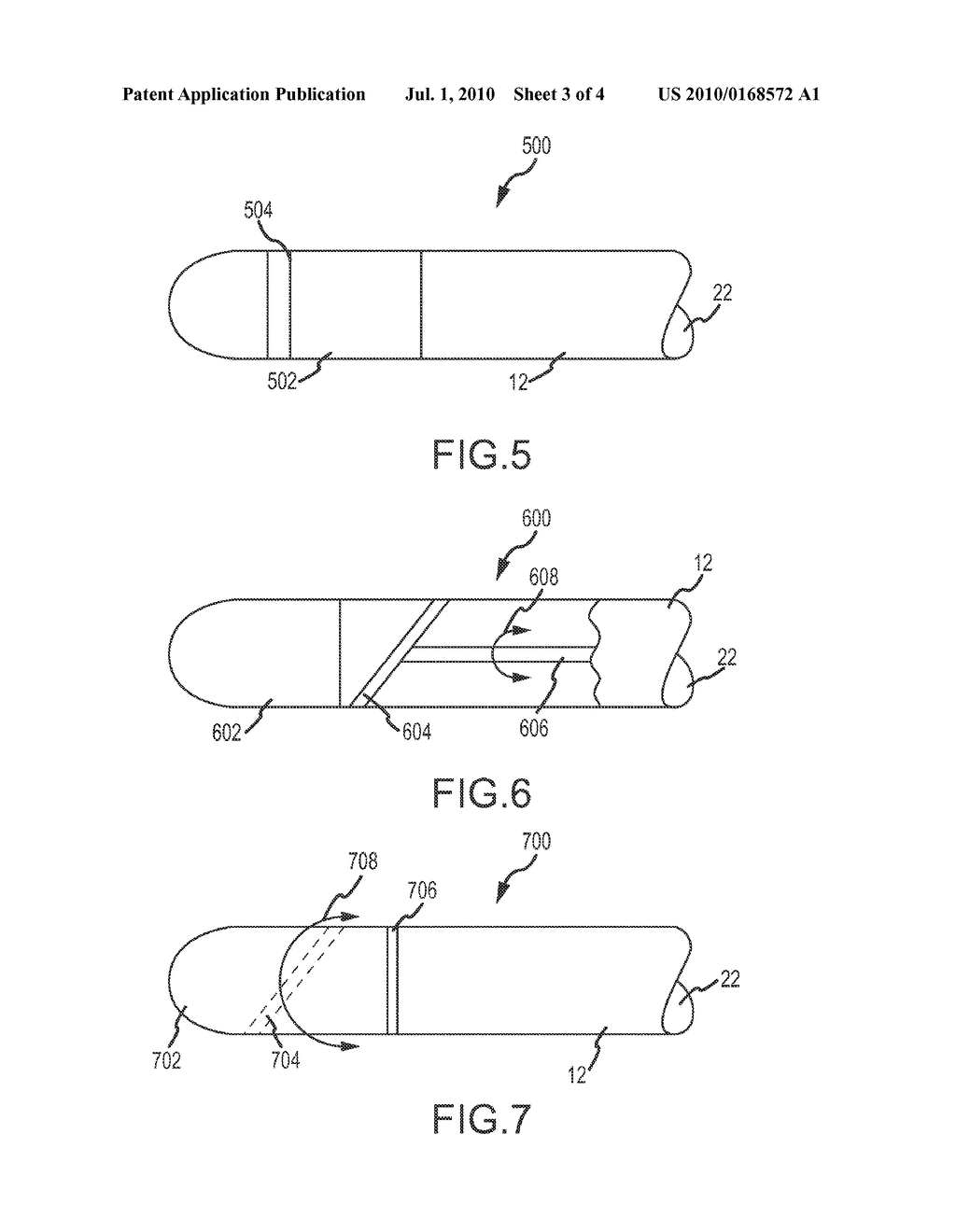 Apparatus and Methods for Acoustic Monitoring of Ablation Procedures - diagram, schematic, and image 04
