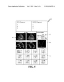 System and Method for Combined ECG-Echo for Cardiac Diagnosis diagram and image