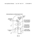CATHETER IMAGING PROBE AND METHOD diagram and image