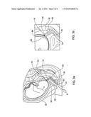 System and method for transfetal (amnion-chorion) membranes transport diagram and image
