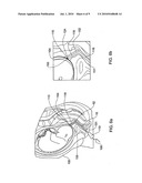 System and method for transfetal (amnion-chorion) membranes transport diagram and image