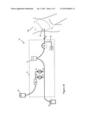 METHODS AND APPARATUS FOR DELIVERING PERITONEAL DIALYSIS (PD) SOLUTION WITH A PERISTALTIC PUMP diagram and image