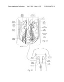 APPARATUS, SYSTEMS, AND METHODS FOR ACHIEVING INTRAVASCULAR, THERMALLY-INDUCED RENAL NEUROMODULATION diagram and image