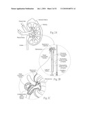 APPARATUS, SYSTEMS, AND METHODS FOR ACHIEVING INTRAVASCULAR, THERMALLY-INDUCED RENAL NEUROMODULATION diagram and image