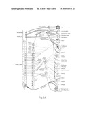 APPARATUS, SYSTEMS, AND METHODS FOR ACHIEVING INTRAVASCULAR, THERMALLY-INDUCED RENAL NEUROMODULATION diagram and image