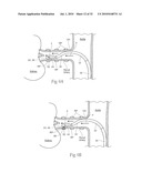 APPARATUS, SYSTEMS, AND METHODS FOR ACHIEVING INTRAVASCULAR, THERMALLY-INDUCED RENAL NEUROMODULATION diagram and image