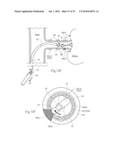 APPARATUS, SYSTEMS, AND METHODS FOR ACHIEVING INTRAVASCULAR, THERMALLY-INDUCED RENAL NEUROMODULATION diagram and image