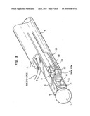 Method and apparatus for removal of tissue diagram and image