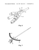 ANASTOMOSIS DEVICE CONFIGURATIONS AND METHODS diagram and image