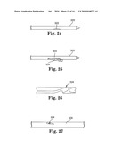 ANASTOMOSIS DEVICE CONFIGURATIONS AND METHODS diagram and image