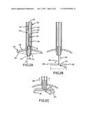 INTRAGASTRIC BALLOON RETRIEVAL MECHANISMS diagram and image