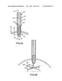 INTRAGASTRIC BALLOON RETRIEVAL MECHANISMS diagram and image