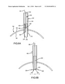 INTRAGASTRIC BALLOON RETRIEVAL MECHANISMS diagram and image