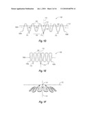 CURVED CLOSURE DEVICE diagram and image