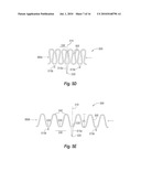 CURVED CLOSURE DEVICE diagram and image