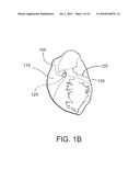 SYSTEMS AND METHODS FOR CLOSING A HOLE IN CARDIAC TISSUE diagram and image