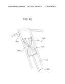 SYSTEMS AND METHODS FOR CLOSING A HOLE IN CARDIAC TISSUE diagram and image