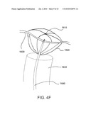 SYSTEMS AND METHODS FOR CLOSING A HOLE IN CARDIAC TISSUE diagram and image