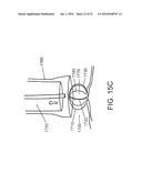 SYSTEMS AND METHODS FOR CLOSING A HOLE IN CARDIAC TISSUE diagram and image