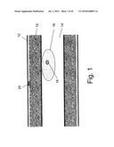 SYSTEM FOR IMPLANTING, ACTIVATING, AND OPERATING AN IMPLANTABLE BATTERY diagram and image