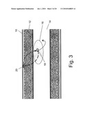 SYSTEM FOR IMPLANTING, ACTIVATING, AND OPERATING AN IMPLANTABLE BATTERY diagram and image