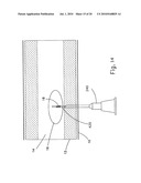 SYSTEM FOR IMPLANTING, ACTIVATING, AND OPERATING AN IMPLANTABLE BATTERY diagram and image